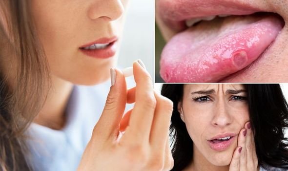 Vitamin-B12-deficiency-symptoms-three-1389155